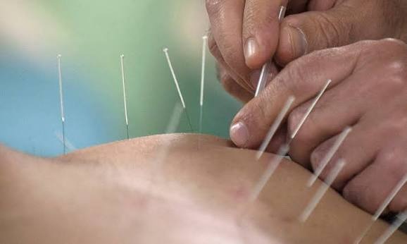 Electro-Acupuncture Therapy Photos Arogya Jeevan