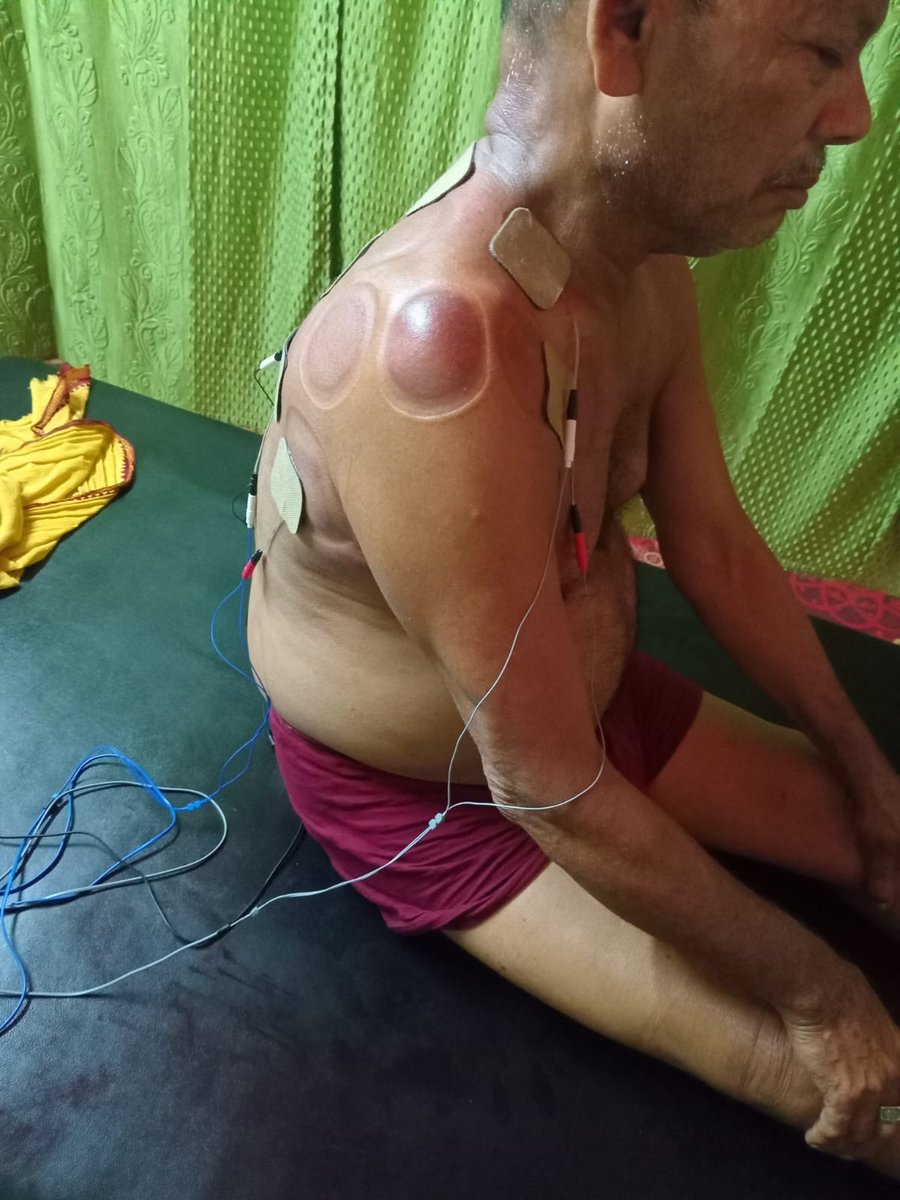 Azon TENS Electrical Therapy Photos